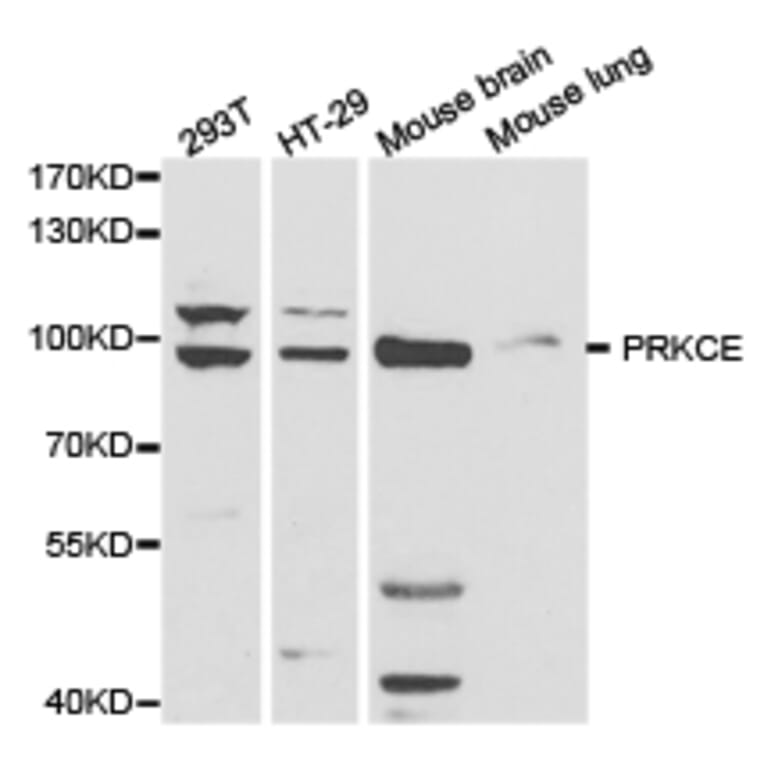 Anti-PKC ε/ PRKCE Antibody from Bioworld Technology (BS6704) - Antibodies.com