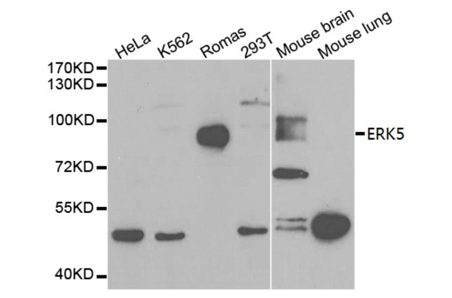 Anti-ERK5 Antibody from Bioworld Technology (BS6705) - Antibodies.com