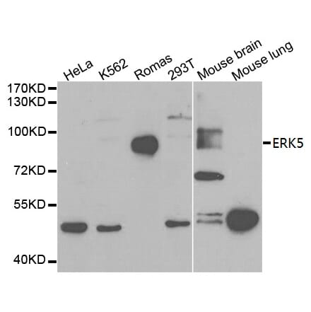 Anti-ERK5 Antibody from Bioworld Technology (BS6705) - Antibodies.com