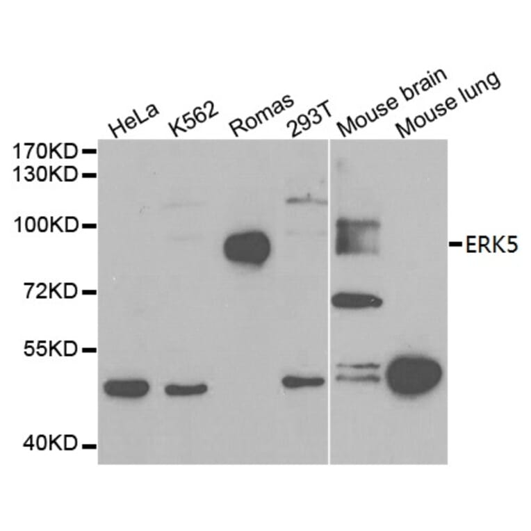 Anti-ERK5 Antibody from Bioworld Technology (BS6705) - Antibodies.com