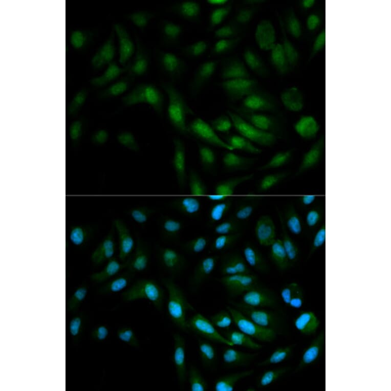 Anti-ERK5 Antibody from Bioworld Technology (BS6705) - Antibodies.com