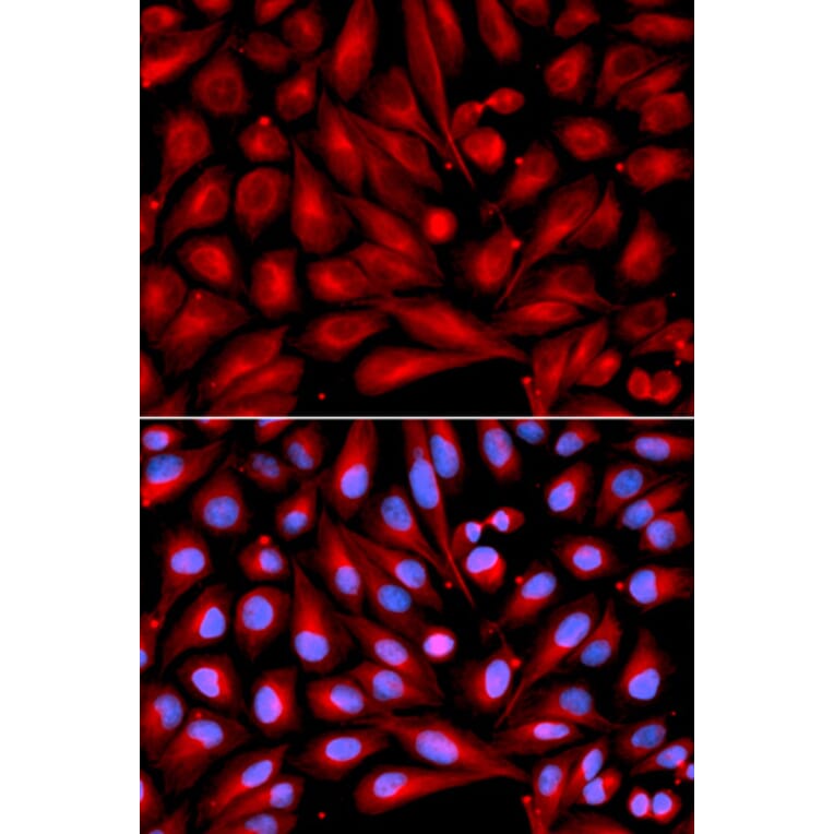 Anti-MKK7/MAP2K7 Antibody from Bioworld Technology (BS6707) - Antibodies.com
