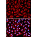 Anti-MKK7/MAP2K7 Antibody from Bioworld Technology (BS6707) - Antibodies.com