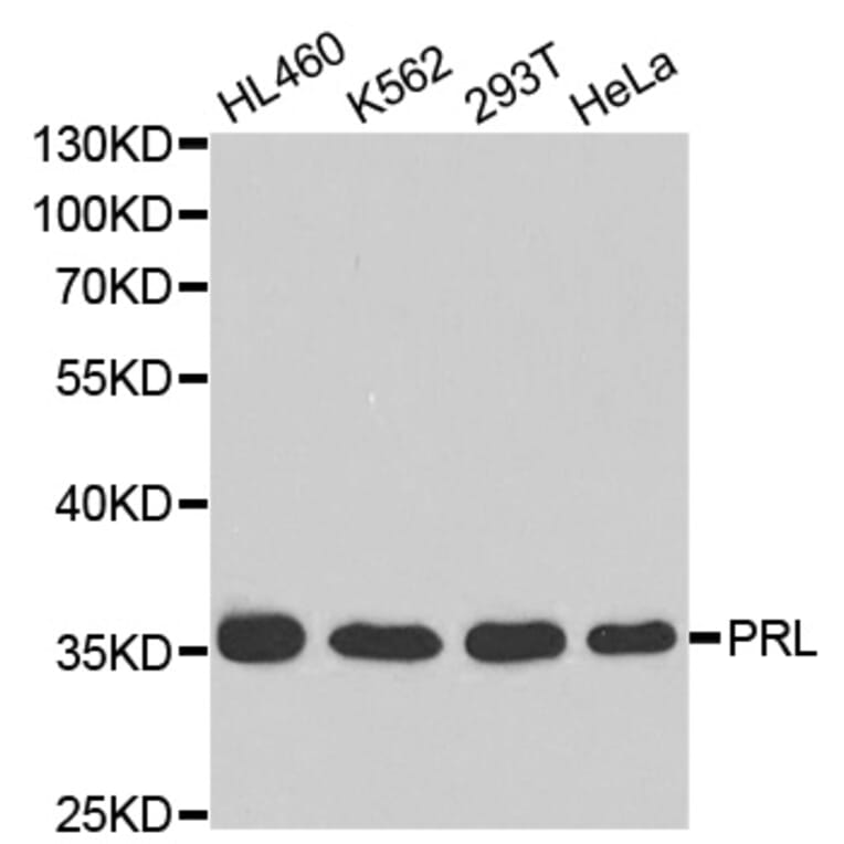 Anti-PRL Antibody from Bioworld Technology (BS6708) - Antibodies.com