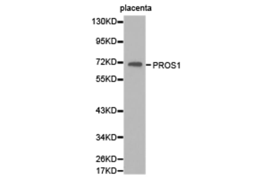 Anti-PROS1 Antibody from Bioworld Technology (BS6710) - Antibodies.com