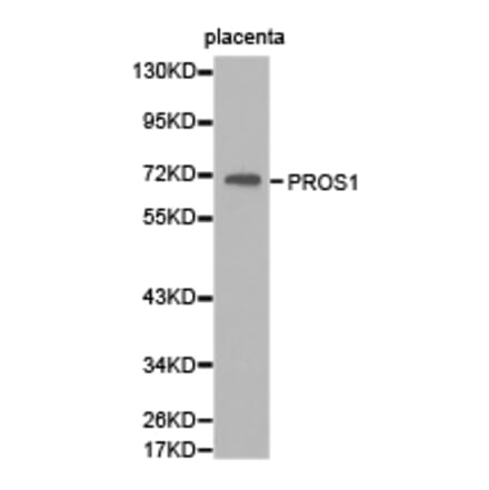 Anti-PROS1 Antibody from Bioworld Technology (BS6710) - Antibodies.com