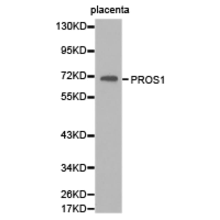 Anti-PROS1 Antibody from Bioworld Technology (BS6710) - Antibodies.com