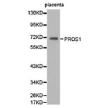 Anti-PROS1 Antibody from Bioworld Technology (BS6710) - Antibodies.com