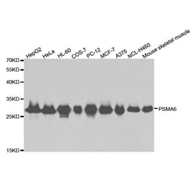 Anti-PSMA6 Antibody from Bioworld Technology (BS6712) - Antibodies.com