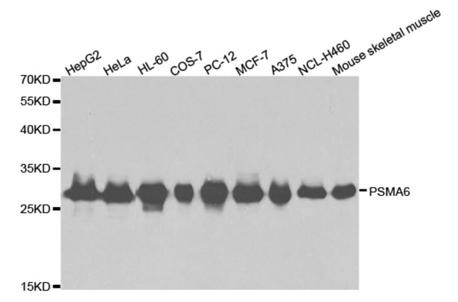 Anti-PSMA6 Antibody from Bioworld Technology (BS6712) - Antibodies.com