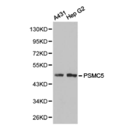 Anti-PSMC5 Antibody from Bioworld Technology (BS6713) - Antibodies.com