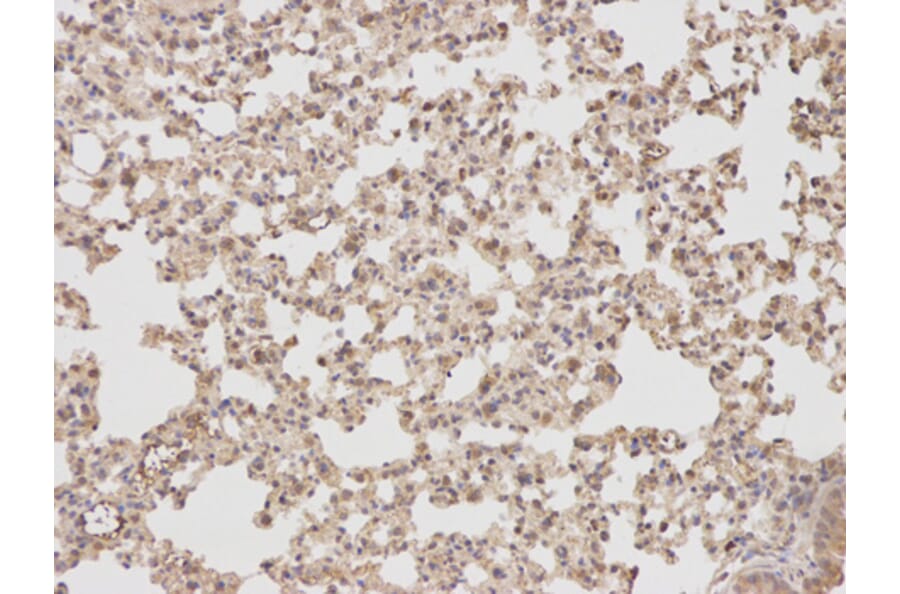 Anti-PTPN2 Antibody from Bioworld Technology (BS6716) - Antibodies.com