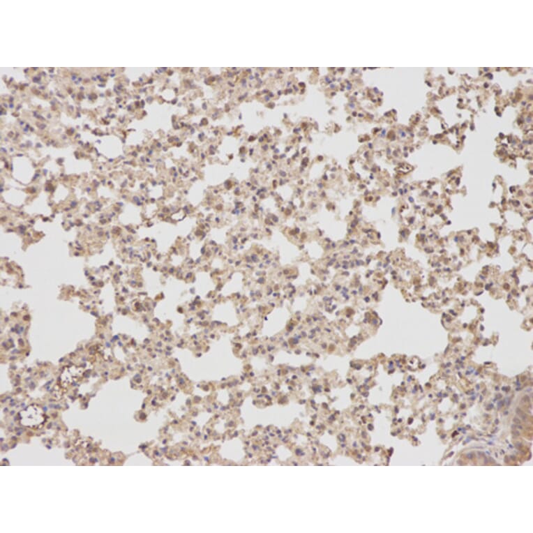 Anti-PTPN2 Antibody from Bioworld Technology (BS6716) - Antibodies.com