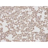 Anti-PTPN2 Antibody from Bioworld Technology (BS6716) - Antibodies.com