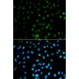 Anti-PTPN2 Antibody from Bioworld Technology (BS6716) - Antibodies.com