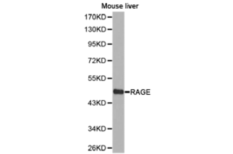 Anti-RAGE Antibody from Bioworld Technology (BS6719) - Antibodies.com