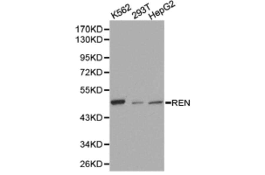 Anti-Renin Antibody from Bioworld Technology (BS6722) - Antibodies.com