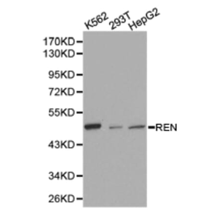 Anti-Renin Antibody from Bioworld Technology (BS6722) - Antibodies.com