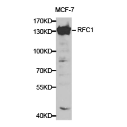 Anti-RFC1 Antibody from Bioworld Technology (BS6723) - Antibodies.com