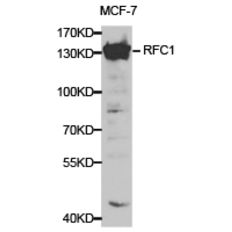 Anti-RFC1 Antibody from Bioworld Technology (BS6723) - Antibodies.com