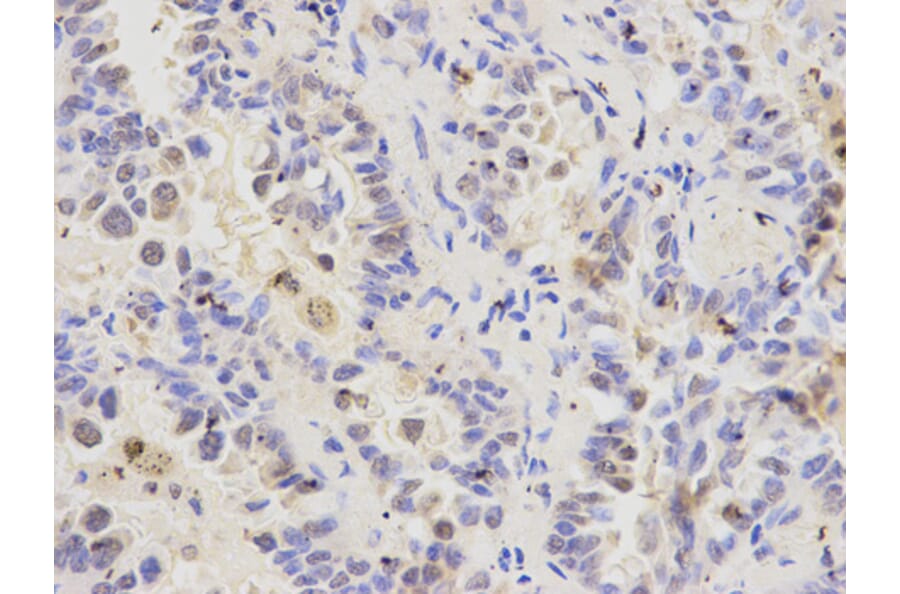 Anti-RFC1 Antibody from Bioworld Technology (BS6723) - Antibodies.com