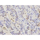 Anti-RFC1 Antibody from Bioworld Technology (BS6723) - Antibodies.com