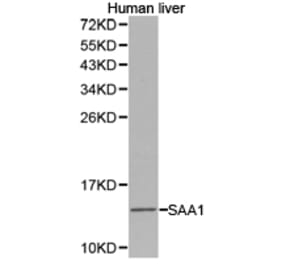 Anti-SAA1 Antibody from Bioworld Technology (BS6727) - Antibodies.com
