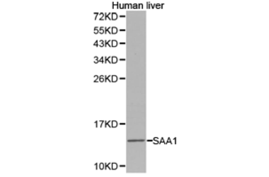 Anti-SAA1 Antibody from Bioworld Technology (BS6727) - Antibodies.com