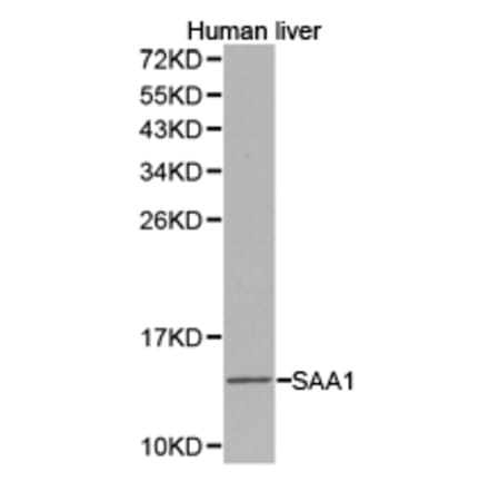 Anti-SAA1 Antibody from Bioworld Technology (BS6727) - Antibodies.com