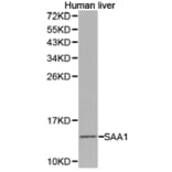 Anti-SAA1 Antibody from Bioworld Technology (BS6727) - Antibodies.com