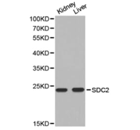 Anti-SDC2 Antibody from Bioworld Technology (BS6729) - Antibodies.com