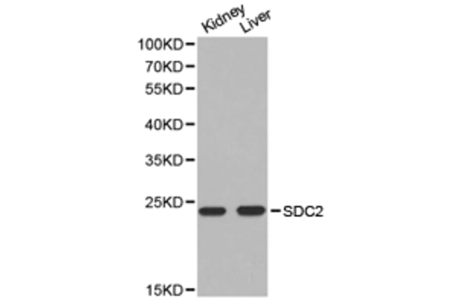 Anti-SDC2 Antibody from Bioworld Technology (BS6729) - Antibodies.com