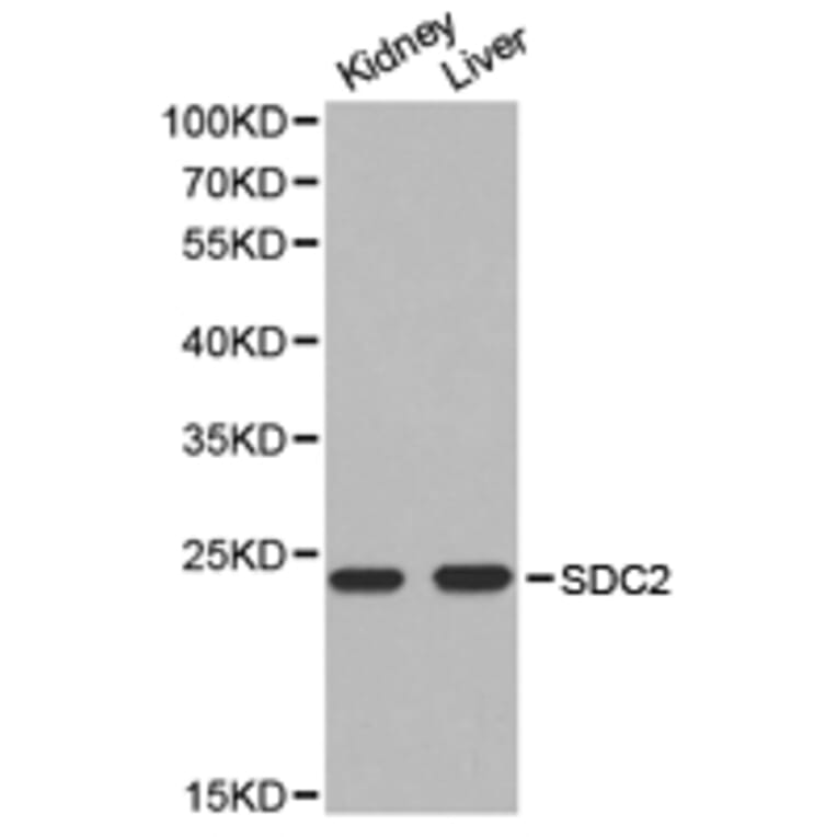 Anti-SDC2 Antibody from Bioworld Technology (BS6729) - Antibodies.com