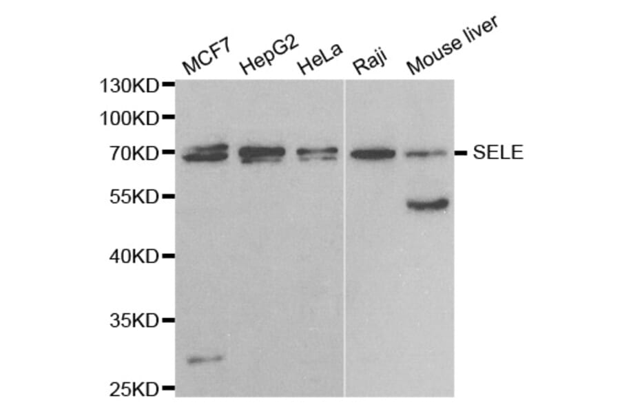 Anti-SELE Antibody from Bioworld Technology (BS6730) - Antibodies.com