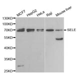Anti-SELE Antibody from Bioworld Technology (BS6730) - Antibodies.com