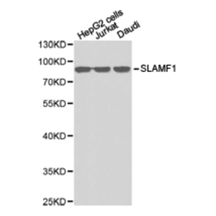 Anti-SLAMF1 Antibody from Bioworld Technology (BS6732) - Antibodies.com