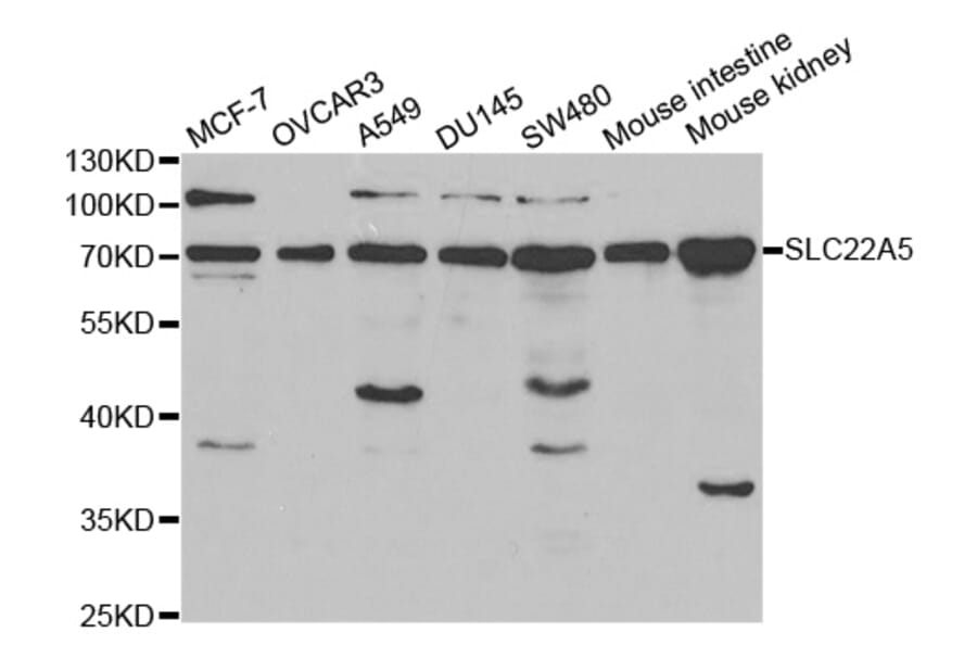 Anti-SLC22A5 Antibody from Bioworld Technology (BS6733) - Antibodies.com