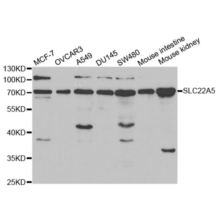 Anti-SLC22A5 Antibody from Bioworld Technology (BS6733) - Antibodies.com