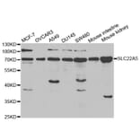 Anti-SLC22A5 Antibody from Bioworld Technology (BS6733) - Antibodies.com