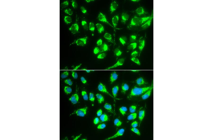 Anti-SLC22A5 Antibody from Bioworld Technology (BS6733) - Antibodies.com
