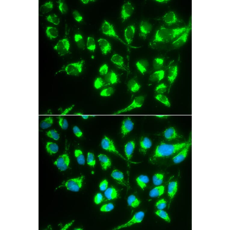 Anti-SLC22A5 Antibody from Bioworld Technology (BS6733) - Antibodies.com