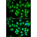 Anti-SLC22A5 Antibody from Bioworld Technology (BS6733) - Antibodies.com