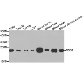 Anti-SOD2 Antibody from Bioworld Technology (BS6734) - Antibodies.com