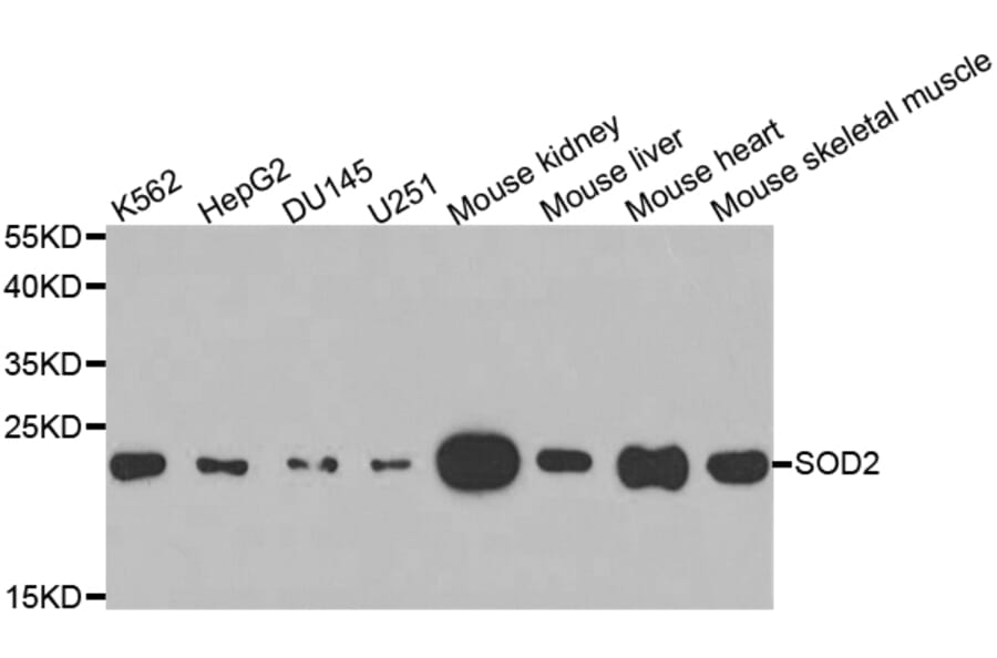 Anti-SOD2 Antibody from Bioworld Technology (BS6734) - Antibodies.com
