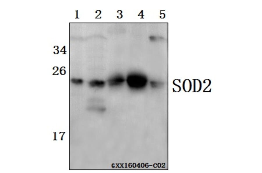 Anti-SOD2 Antibody from Bioworld Technology (BS6734) - Antibodies.com