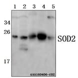 Anti-SOD2 Antibody from Bioworld Technology (BS6734) - Antibodies.com