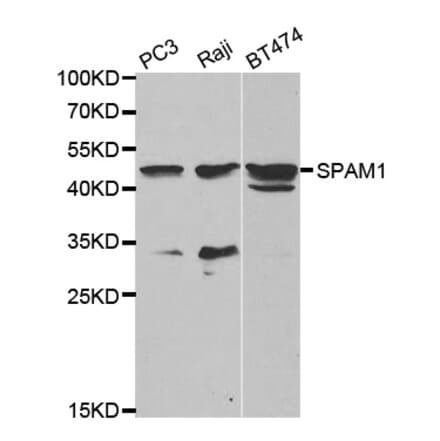 Anti-SPAM1 Antibody from Bioworld Technology (BS6737) - Antibodies.com