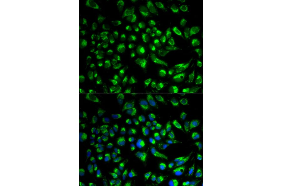 Anti-SPAM1 Antibody from Bioworld Technology (BS6737) - Antibodies.com