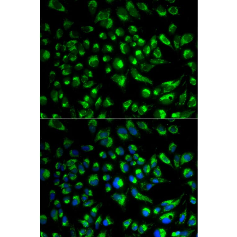 Anti-SPAM1 Antibody from Bioworld Technology (BS6737) - Antibodies.com