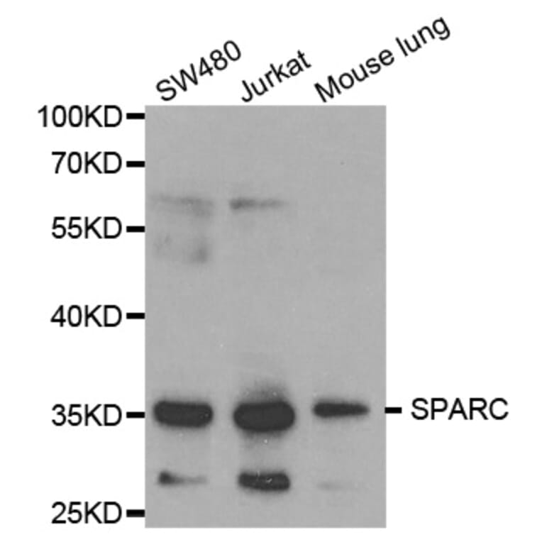 Anti-SPARC Antibody from Bioworld Technology (BS6738) - Antibodies.com